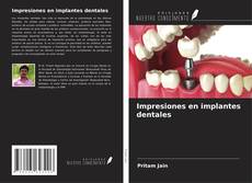 Couverture de Impresiones en implantes dentales