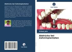 Capa do livro de Abdrücke bei Zahnimplantaten 