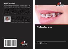 Bookcover of Malocclusione