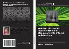 Bookcover of Reabsorción cervical invasiva debida al blanqueamiento interno iontoforético