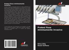 Bookcover of Protesi fissa minimamente invasiva