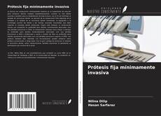 Bookcover of Prótesis fija mínimamente invasiva