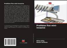 Prothèse fixe mini-invasive kitap kapağı