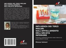 Bookcover of INFLUENZA DEI TERZI MOLARI SULL'AFFOLLAMENTO DELL'ARCATA INFERIORE
