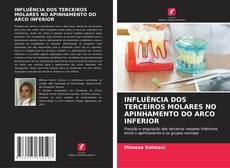 INFLUÊNCIA DOS TERCEIROS MOLARES NO APINHAMENTO DO ARCO INFERIOR的封面