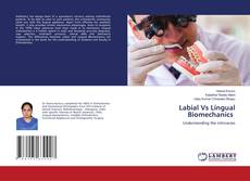 Bookcover of Labial Vs Lingual Biomechanics