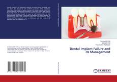 Portada del libro de Dental Implant Failure and its Management