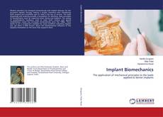 Copertina di Implant Biomechanics