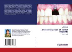 Buchcover von Osseointegration of Dental Implants