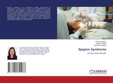Buchcover von Sjogren Syndrome