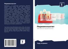 Bookcover of Периимплантит