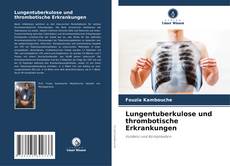 Portada del libro de Lungentuberkulose und thrombotische Erkrankungen