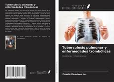 Bookcover of Tuberculosis pulmonar y enfermedades trombólicas