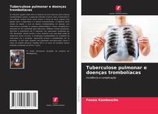 Capa do livro de Tuberculose pulmonar e doenças trombolíacas 