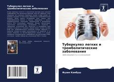 Bookcover of Туберкулез легких и тромболитические заболевания