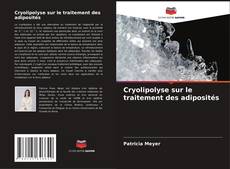 Capa do livro de Cryolipolyse sur le traitement des adiposités 