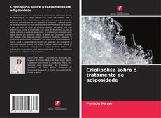 Bookcover of Criolipólise sobre o tratamento de adiposidade