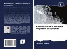 Bookcover of Криолиполиз в лечении жировых отложений