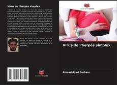 Bookcover of Virus de l'herpès simplex