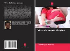 Capa do livro de Vírus do herpes simplex 