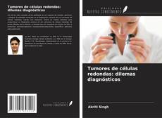 Tumores de células redondas: dilemas diagnósticos kitap kapağı
