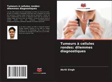 Buchcover von Tumeurs à cellules rondes: dilemmes diagnostiques