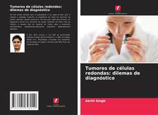 Tumores de células redondas: dilemas de diagnóstico kitap kapağı