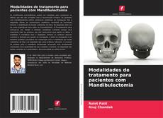 Buchcover von Modalidades de tratamento para pacientes com Mandibulectomia