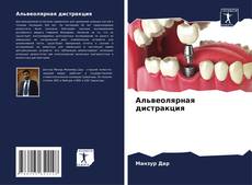 Bookcover of Альвеолярная дистракция