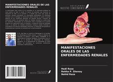 Bookcover of MANIFESTACIONES ORALES DE LAS ENFERMEDADES RENALES