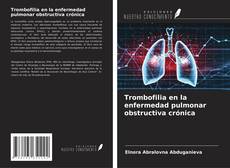 Capa do livro de Trombofilia en la enfermedad pulmonar obstructiva crónica 