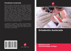 Capa do livro de Ortodontia Acelerada 