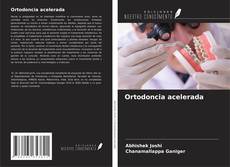 Couverture de Ortodoncia acelerada