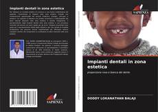 Capa do livro de Impianti dentali in zona estetica 