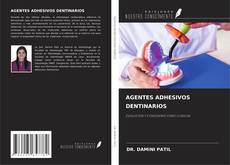 Bookcover of AGENTES ADHESIVOS DENTINARIOS