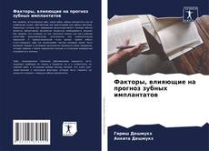 Bookcover of Факторы, влияющие на прогноз зубных имплантатов