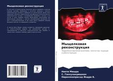 Couverture de Мыщелковая реконструкция