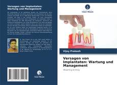 Couverture de Versagen von Implantaten: Wartung und Management