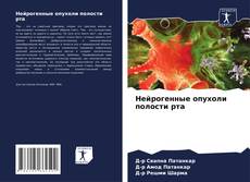 Buchcover von Нейрогенные опухоли полости рта