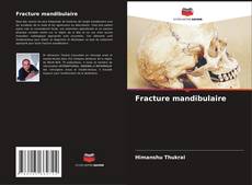 Capa do livro de Fracture mandibulaire 