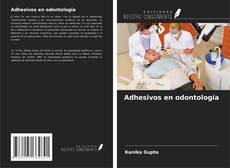 Обложка Adhesivos en odontología