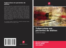 Bookcover of Tuberculose em pacientes de diálise: