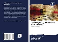 Bookcover of Туберкулез у пациентов на диализе: