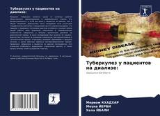 Buchcover von Туберкулез у пациентов на диализе: