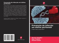 Buchcover von Prevenção da infecção em diálise peritoneal