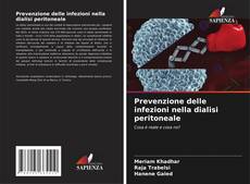 Buchcover von Prevenzione delle infezioni nella dialisi peritoneale