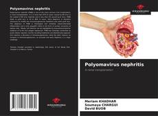 Capa do livro de Polyomavirus nephritis 