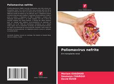 Buchcover von Poliomavírus nefrite