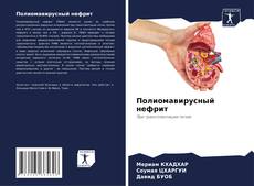 Capa do livro de Полиомавирусный нефрит 