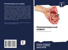 Portada del libro de Полиомавирусный нефрит